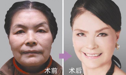 徐海星整容前后照片对比徐海星整容前后对比-第1张图片