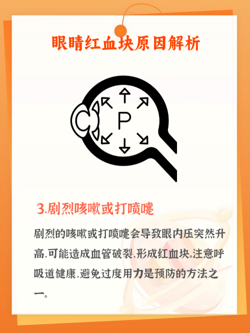 打喷嚏闭眼睛的原理打喷嚏与闭眼睛的原理-第1张图片