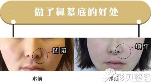 徐海星整容前后徐海星整容前后对比-第1张图片