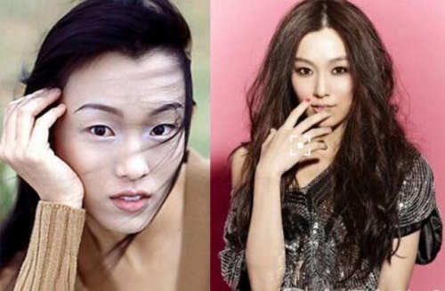 徐海星整容前后徐海星整容前后对比-第2张图片
