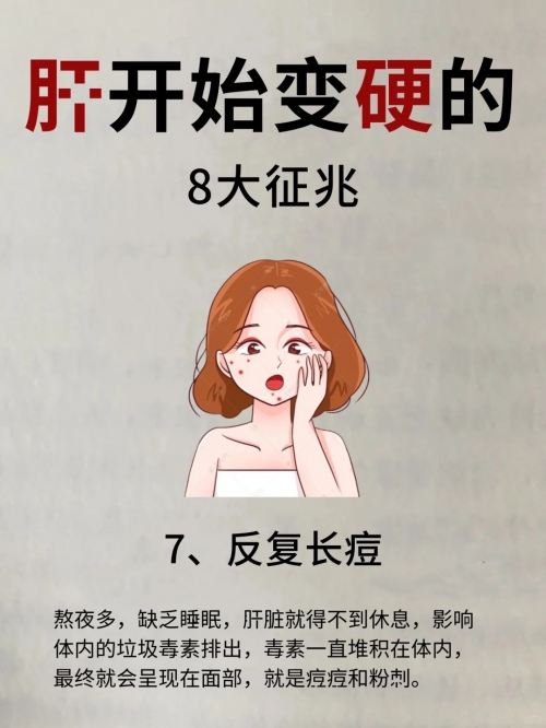 放屁喷粪属于什么病喷气式放屁