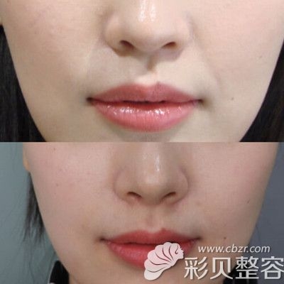 徐海星整容前后徐海星整容前后对比-第1张图片