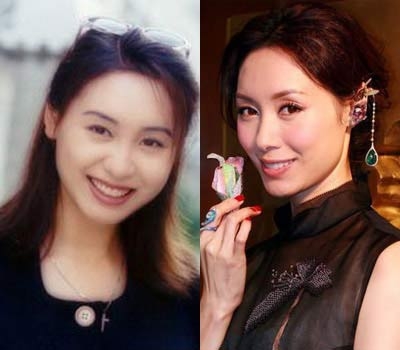 徐海星整容前后徐海星整容前后对比